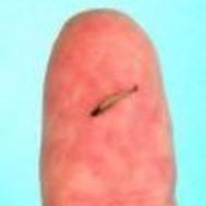 fischfinger